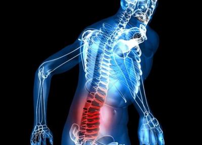 نکاتی برای رهایی از درد سیاتیک نکاتی برای رهایی از درد سیاتیک